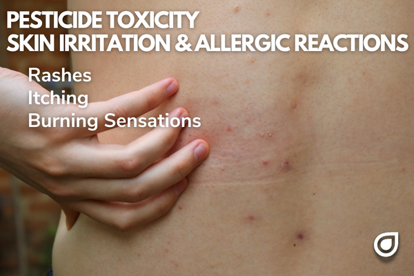 Skin Irritation and Allergic Reactions via Pesticide Exposure Acute Symptoms