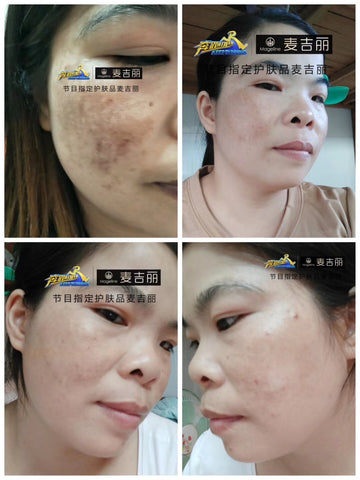 skincare for pigmentation