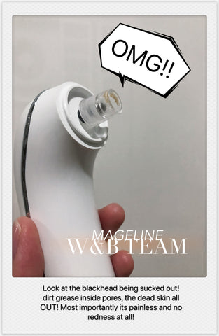 Mageline Blackhead Vacuum Remover