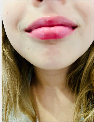 After sleep magic lip repair