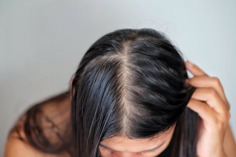 Thinning hair in women: Why does it happen and what helps? – NourishVita