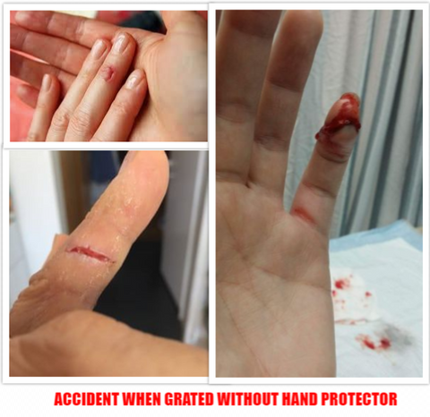 grater hand protector