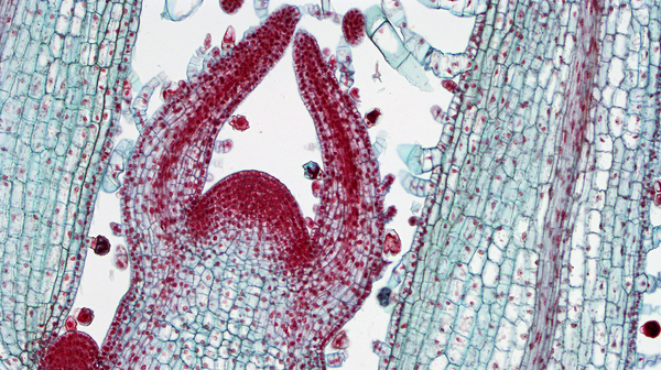 Shoot apical meristem showing very high cell density.