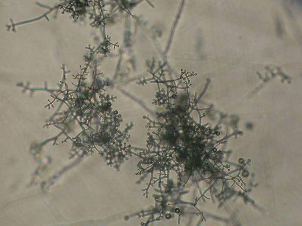 Trichoderma a beneficial fungi under magnification