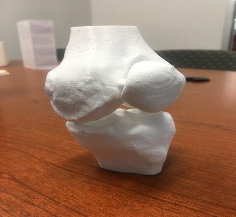 3d Printed Knee from GL Robotics