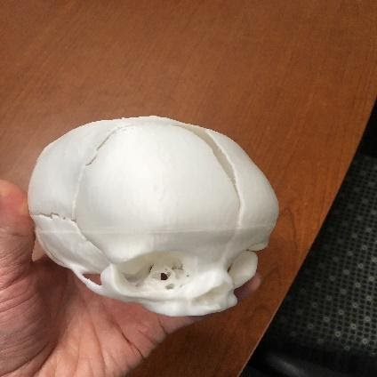 3D printed cranium from GL Robotics