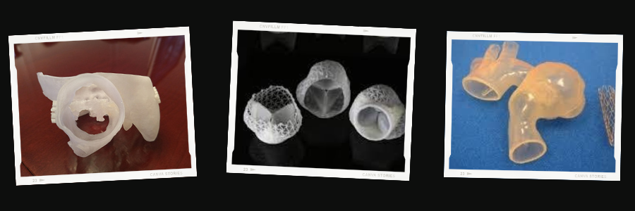 3D printed heart valves; three images