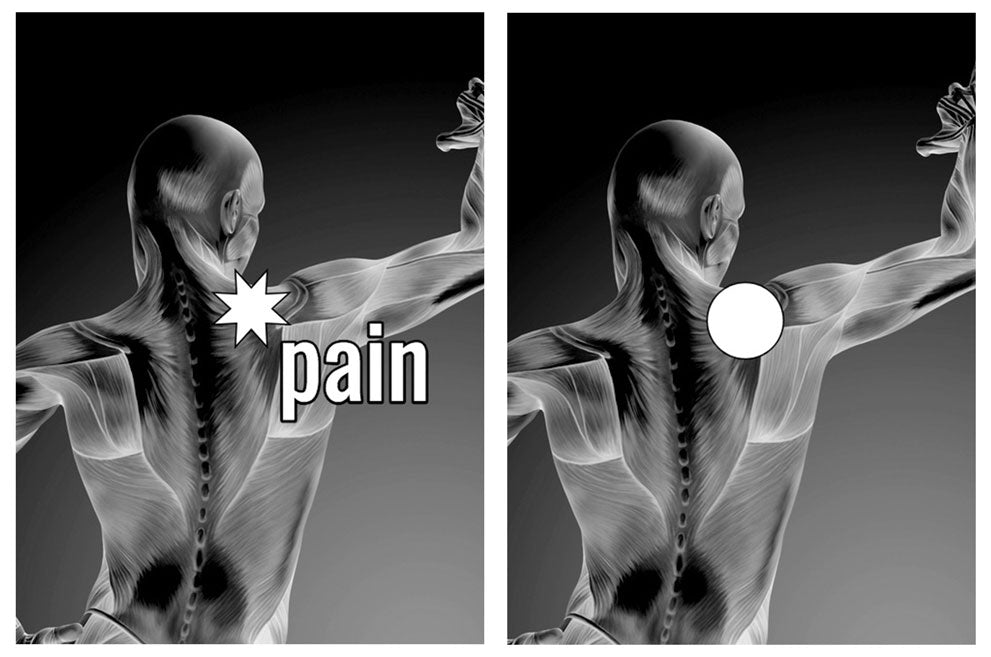 Neck Pain and Placement for FITCUPP® | Low Effort FITCUPPING FITCUPP® Self Fit Inc. Contemporary Cupping