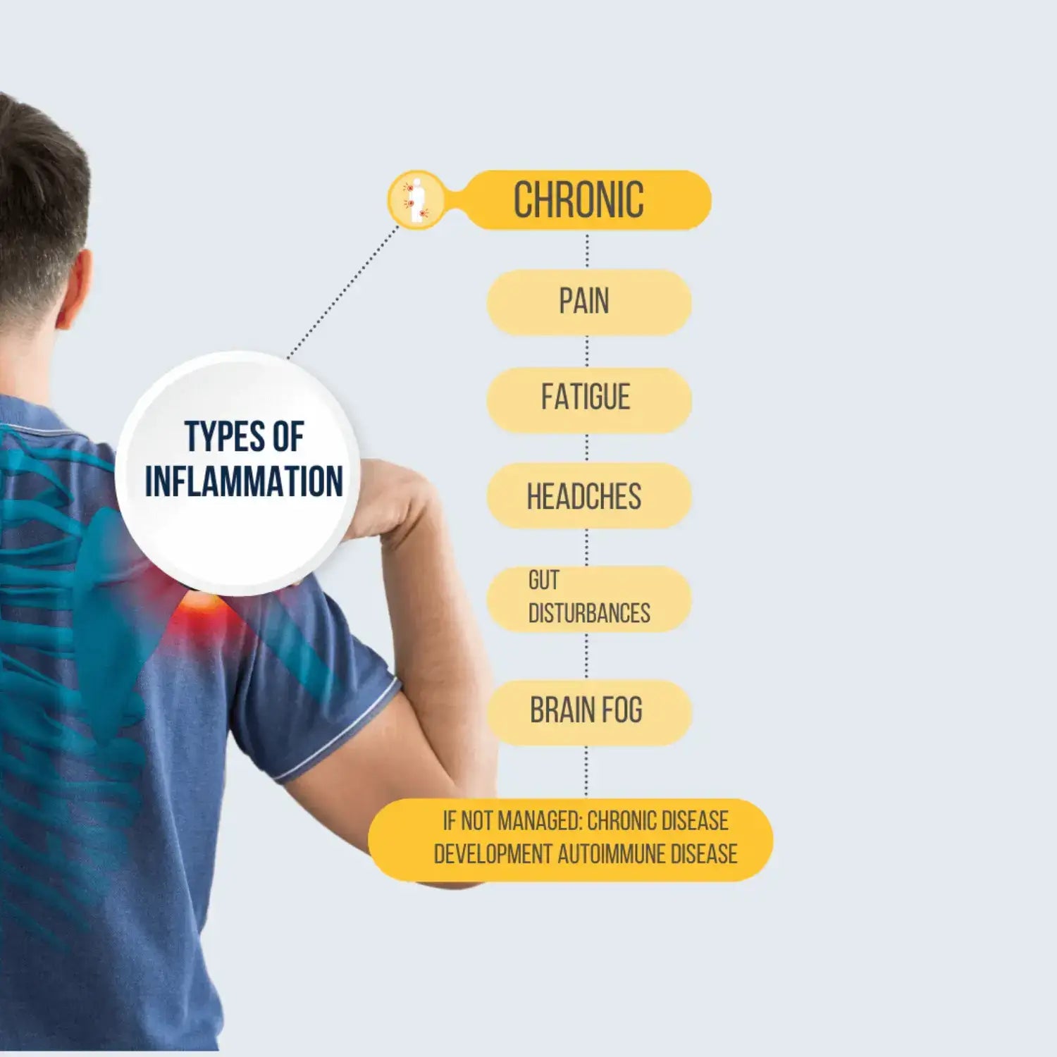 Illustration of type of inflammations with highlighted pain points in the shoulder.
