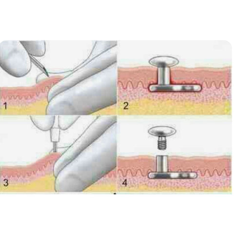 Dermal Piercing Process How Do Dermal Piercings Work