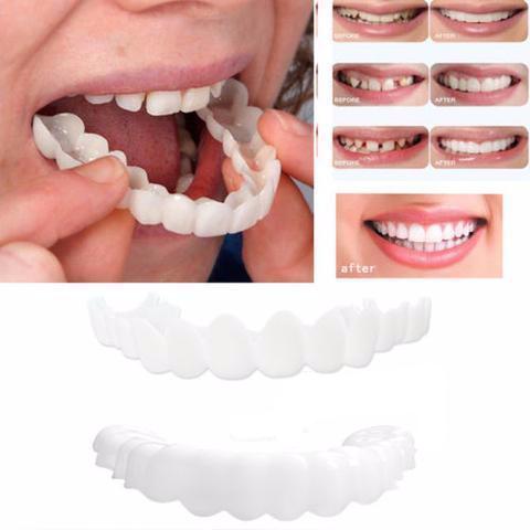 Instant Perfect Smile Upper & Lower Clip/Snap On Veneers for Perfect T ...