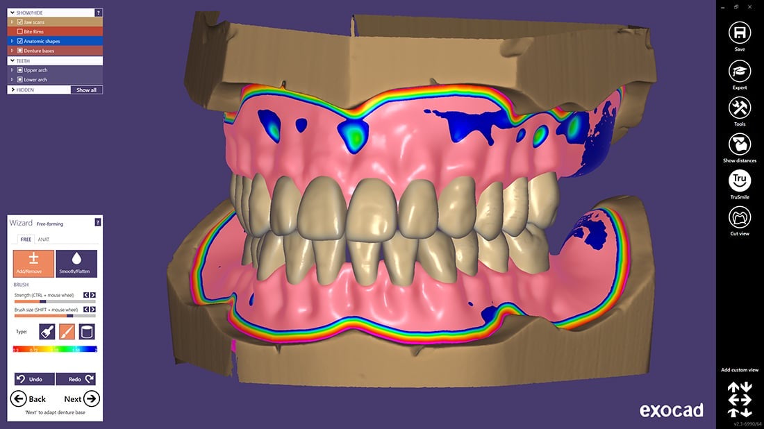 exocad dental software download crack