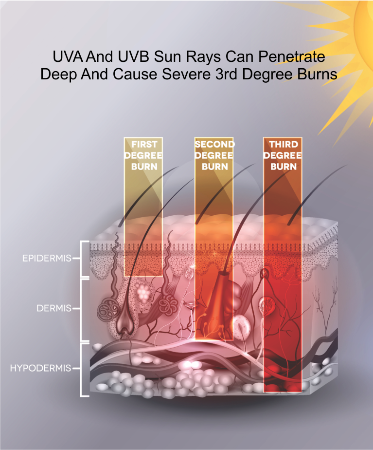 Illustration showing how both UVA and UVB sun rays can penetrate deep into the lower levels of the skin.