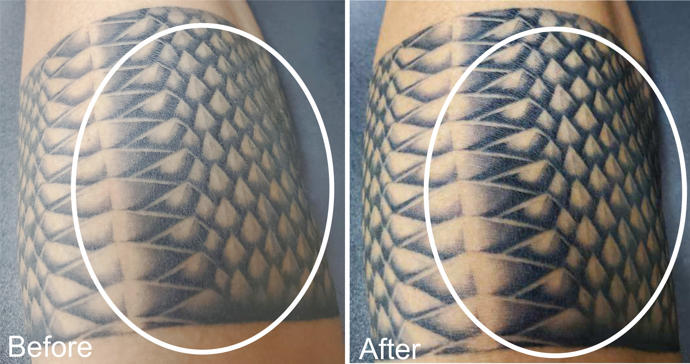 Joseph Tattoo Before and After