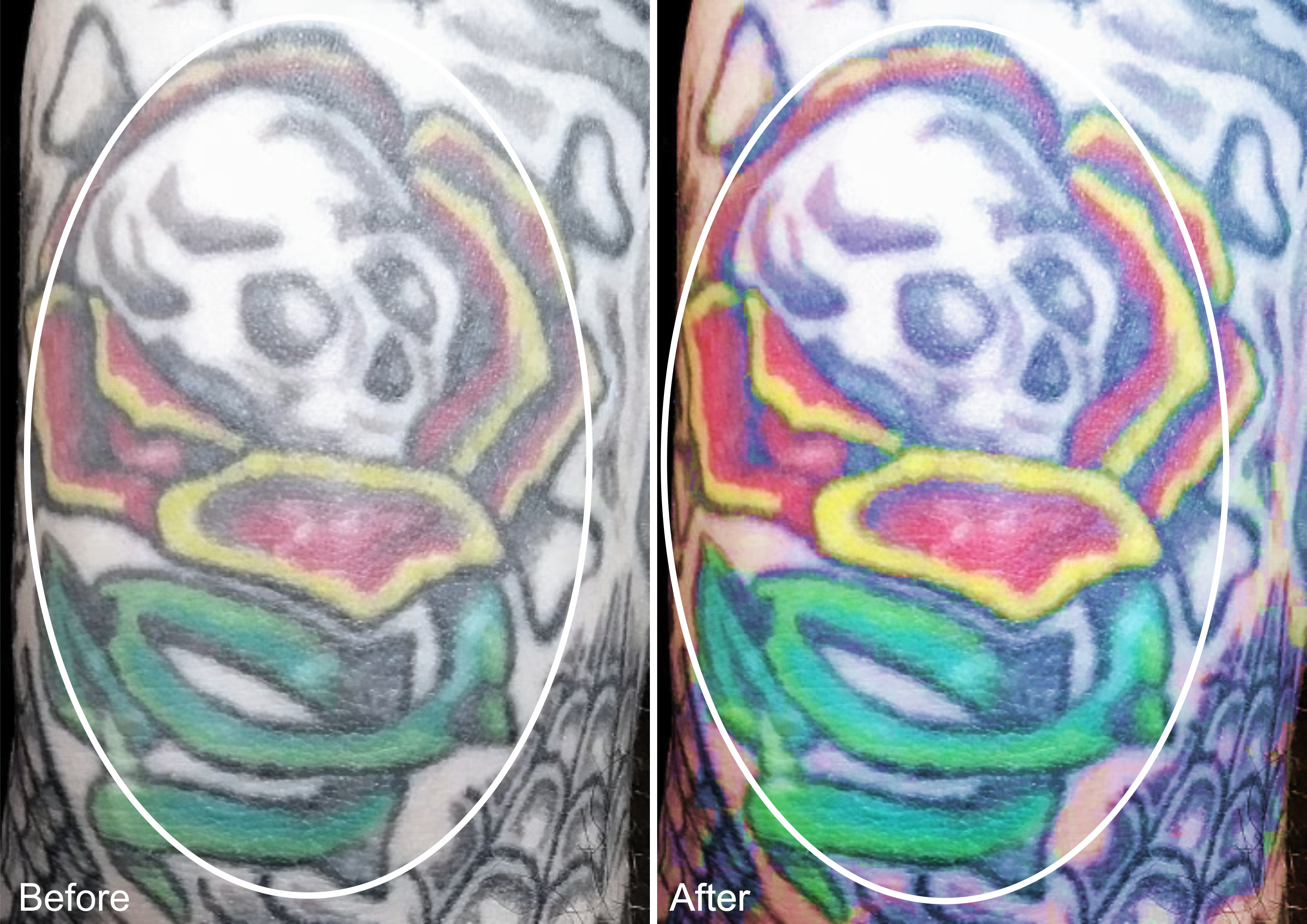 Skull Tattoo Before and After
