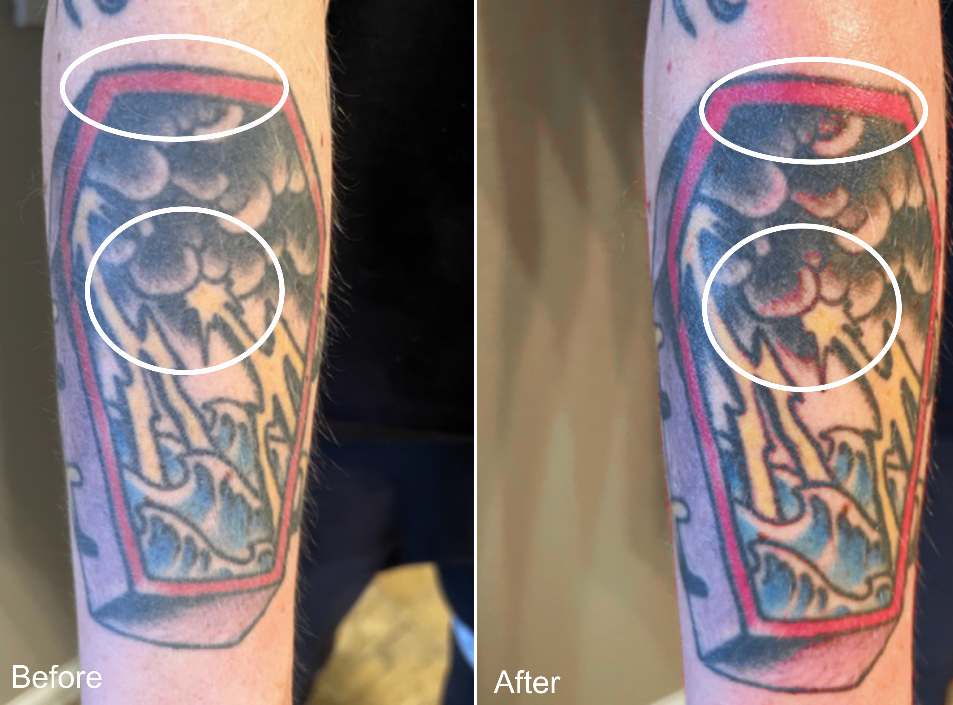 Coffin Tattoo Before and After Image