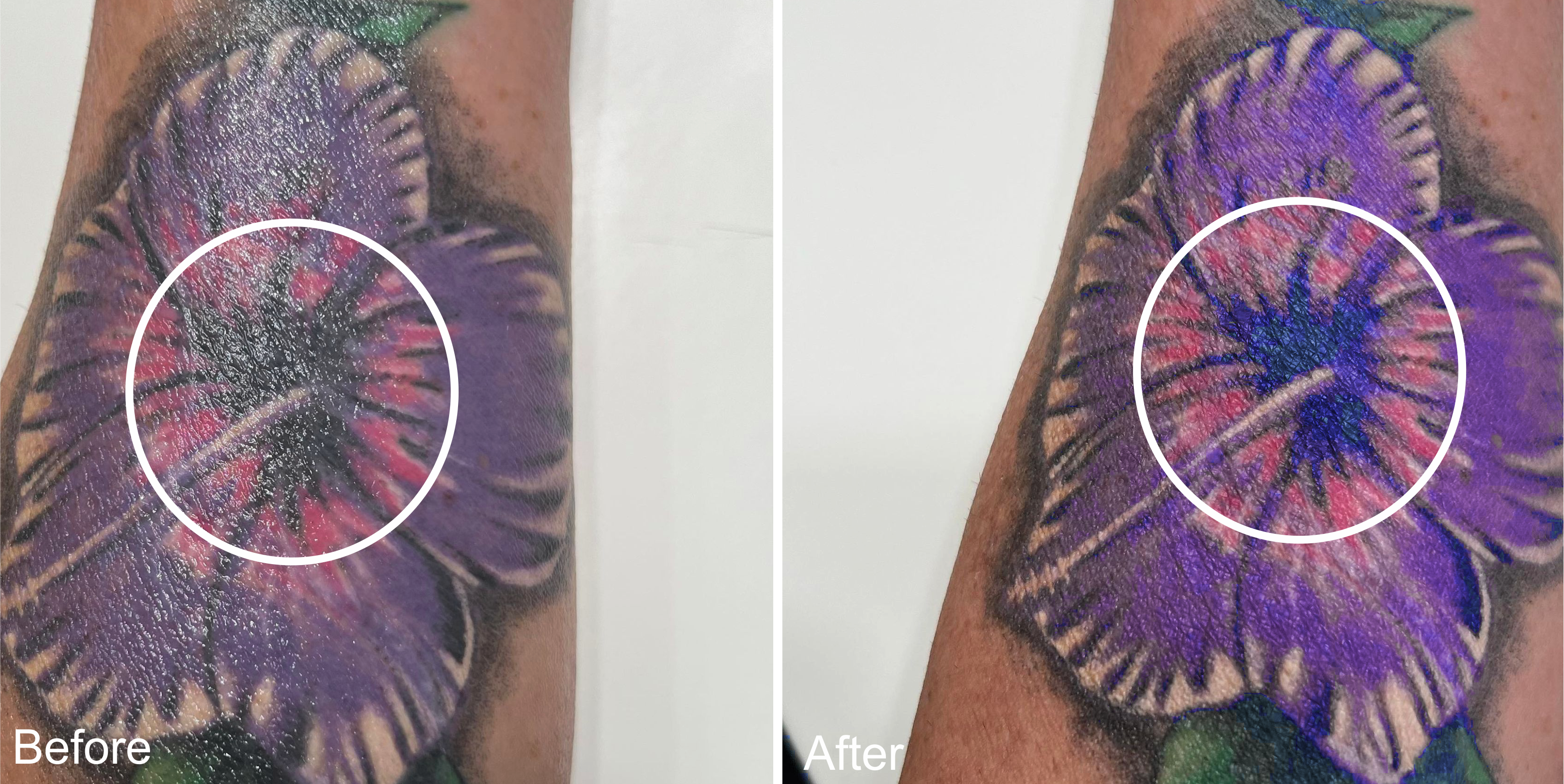 Orchids Tattoo Before and After