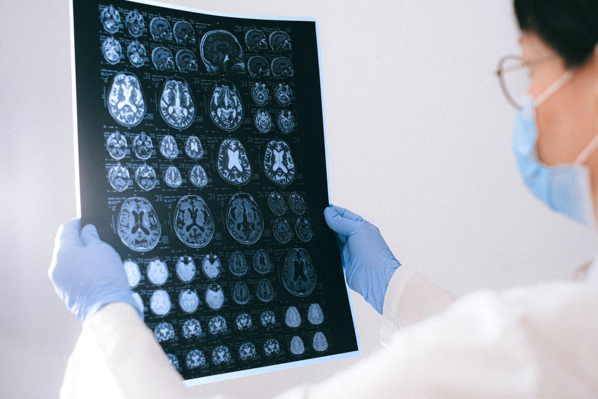 image of a doctor holding an x-ray of a brain