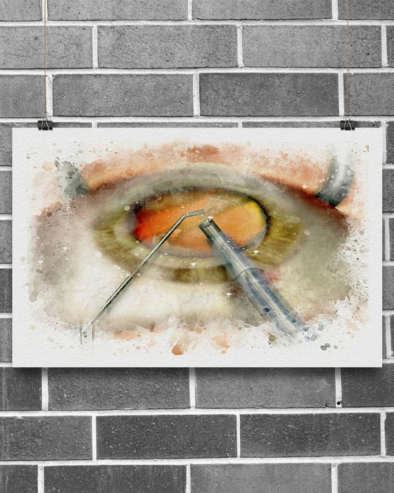 Optometrist Art Cataract Surgery Horizontal Canvas And Poster | Wall Decor Visual Art