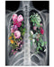 X-Ray Floral Radiologist Vertical Canvas And Poster | Wall Decor Visual Art