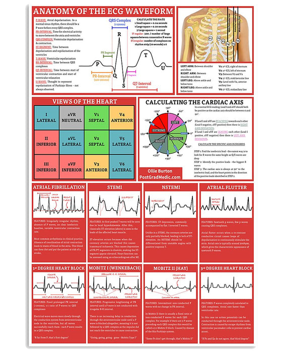 Paramedic Anatomy Of The Egc Waveform Vertical Canvas And Poster | Wall Decor Visual Art