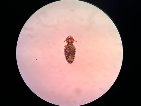 lice in microscope