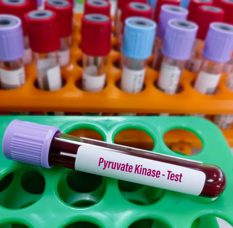 Blood samples for Pyruvate Kinase test for pyruvate kinase deficiency. It's an enzyme found in red blood cells.