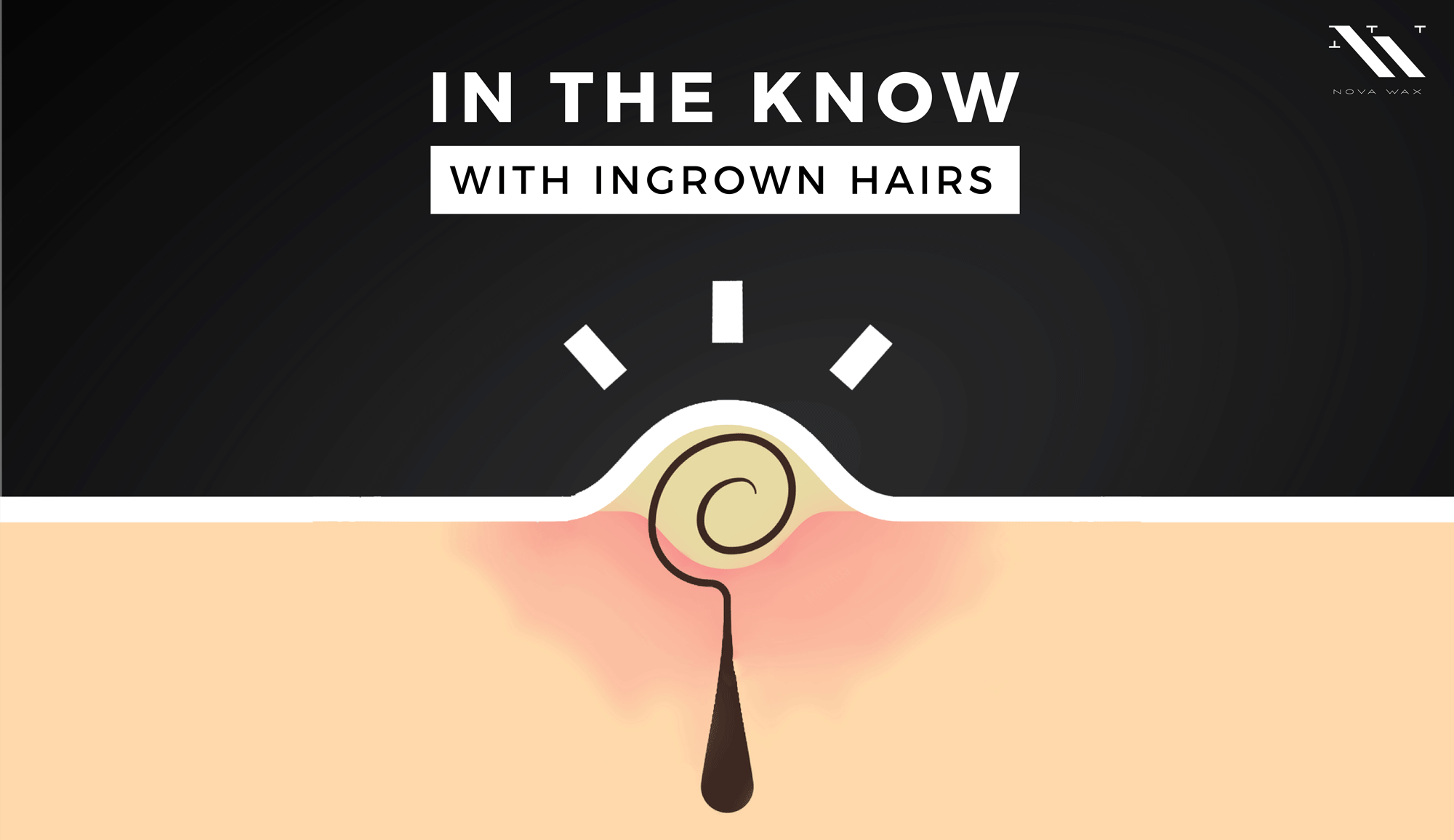 Ingrown Hairs and Waxing 