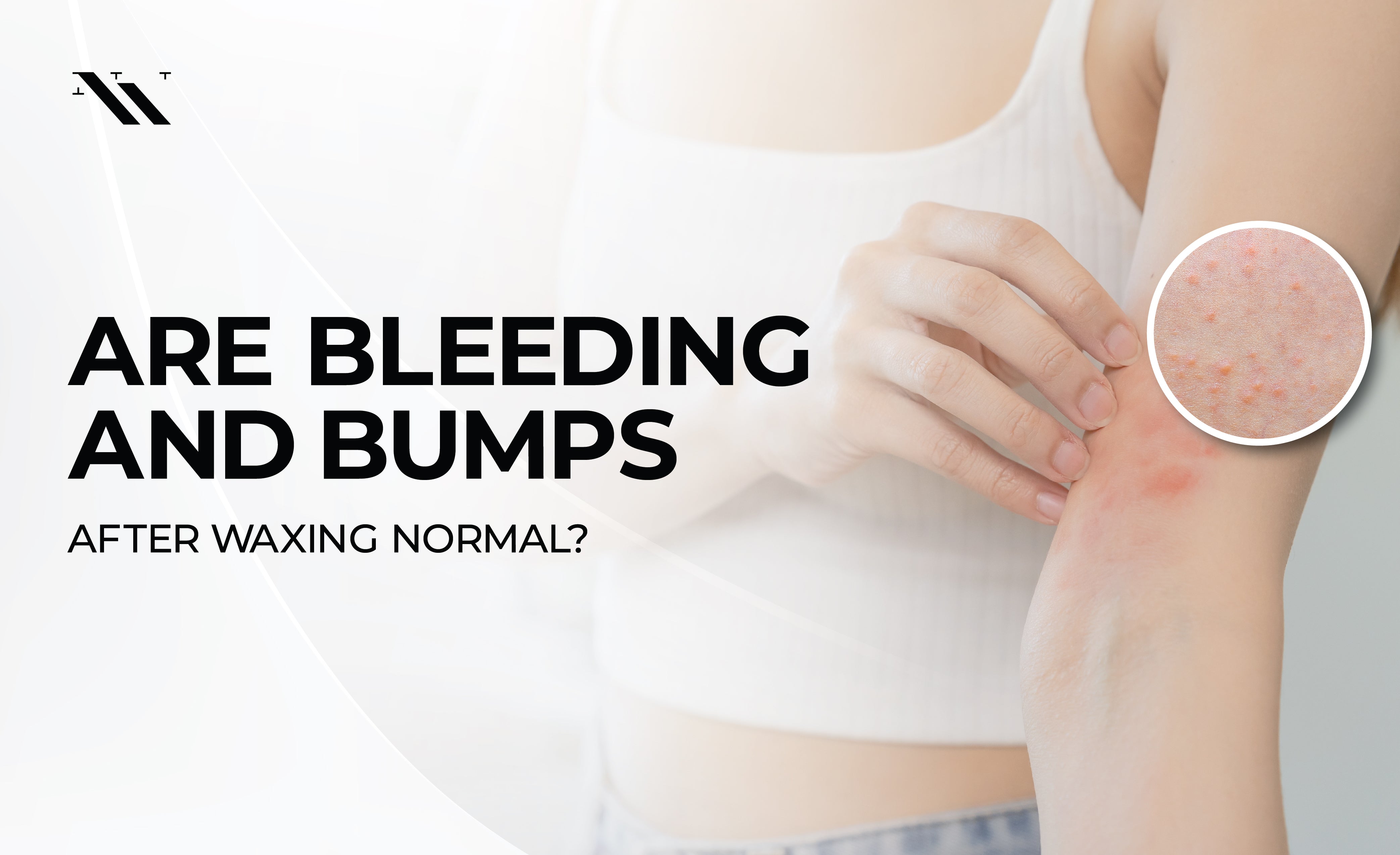 Are Bleeding & Bumps Normal After Waxing?