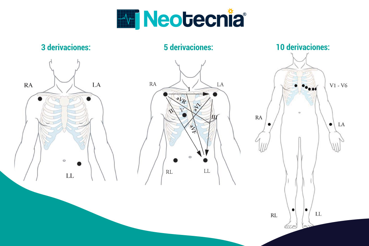 Cómo se colocan los electrodos: derivaciones de electrocardiograma