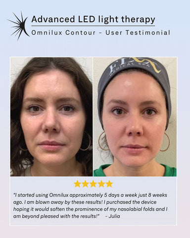 Omnilux Therapy 