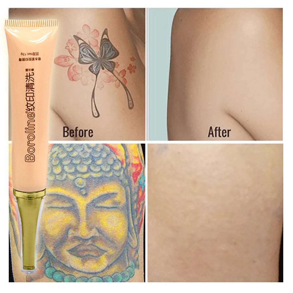 Tattoo Cleaner Permanent Tattoo Removal Cream Fashion No Need for Pain Skin  Care  pirkt par zemām cenām internetveikalā Joom