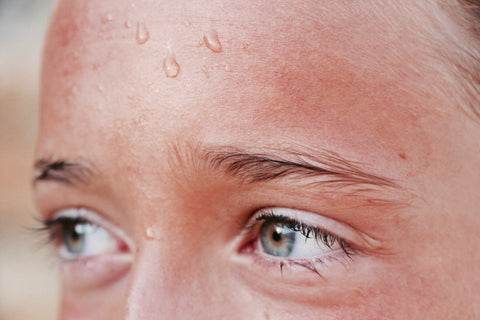 Sweating forehead, for Ivy Leaf Skincare blog