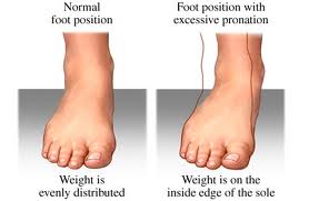 walking supination