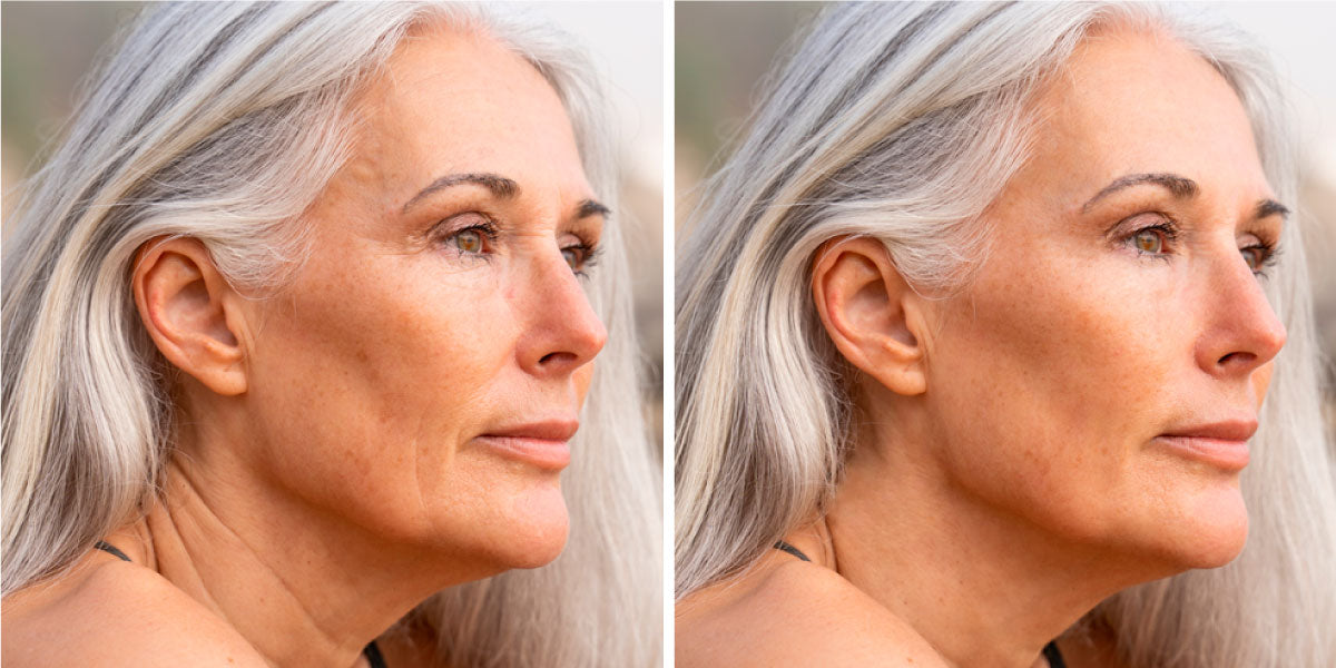 middle age women before and after using the anti-aging skincare routine Oceanly ATTITUDE