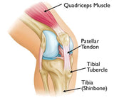 Osgood-Schlatter Disease (Knee Pain) 