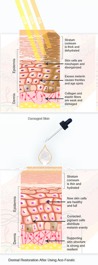 ACE-FERULIC