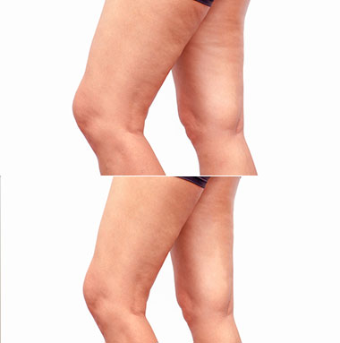 CELLMAXA