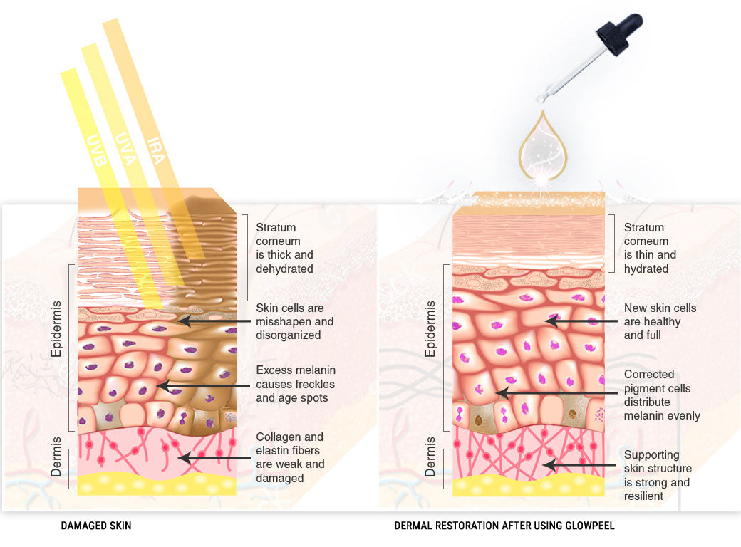 Glowpeel