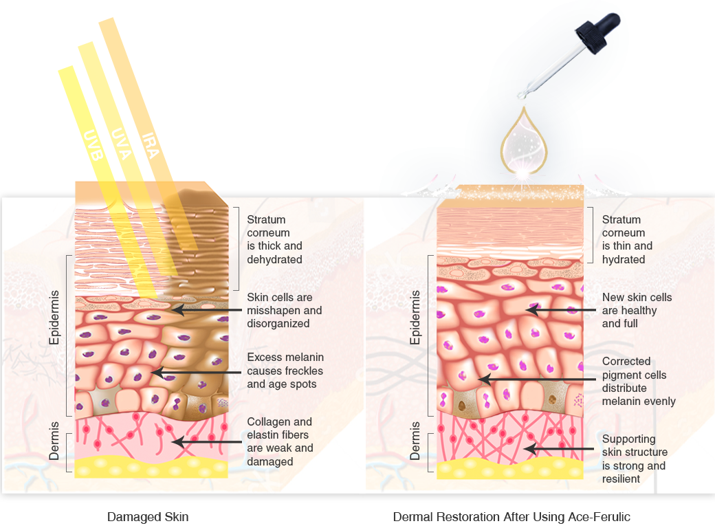 ace-ferulic