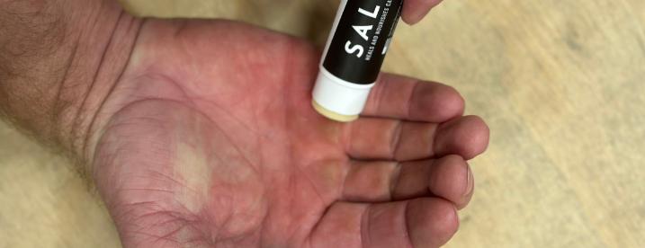 Applying the Salve to your calluses