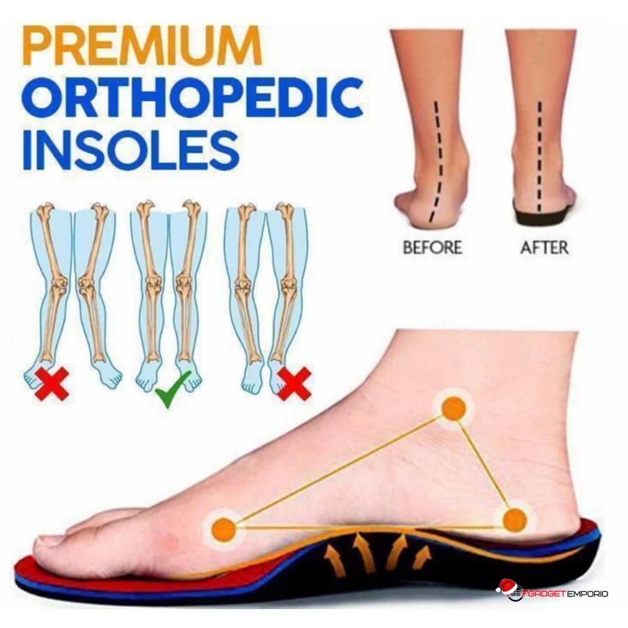 pronation correction insoles