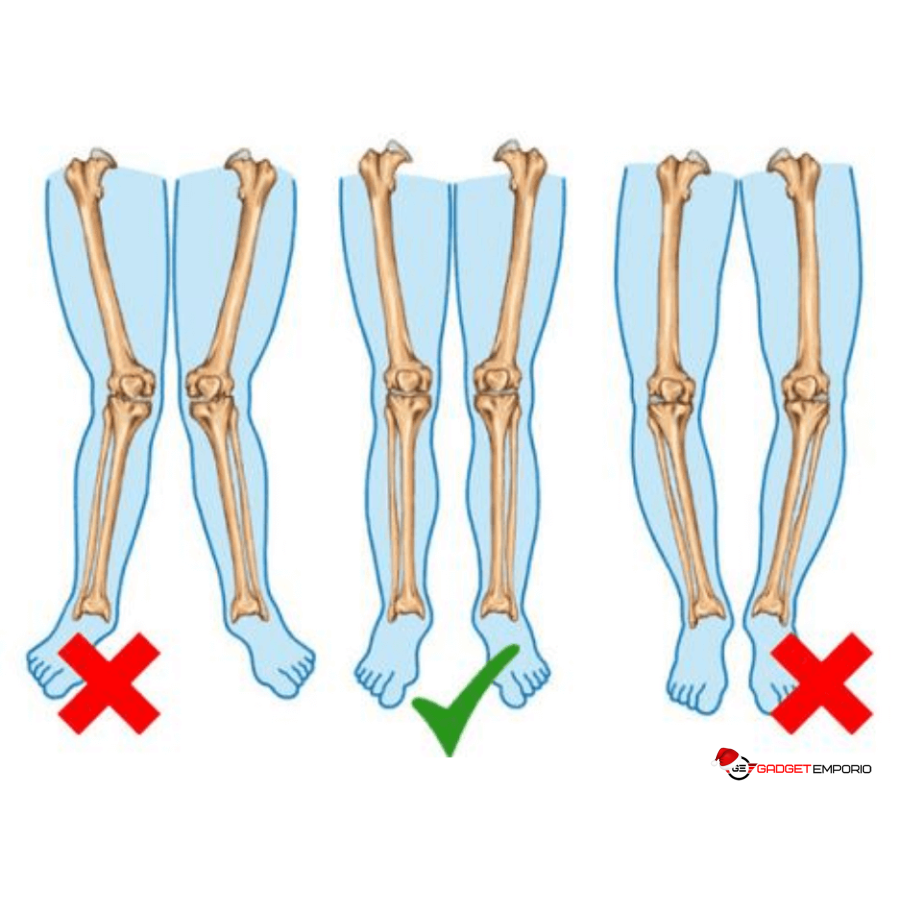 pronation correction insoles