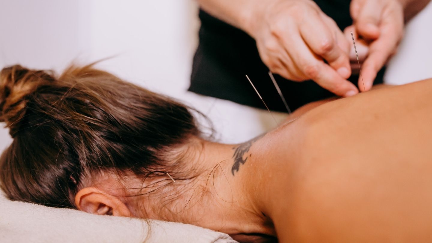 Soulager la fibromyalgie par médecine naturelle : acupuncture