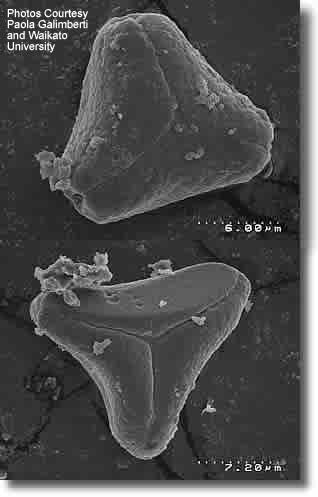 Manuka Pollen - electron microscope image