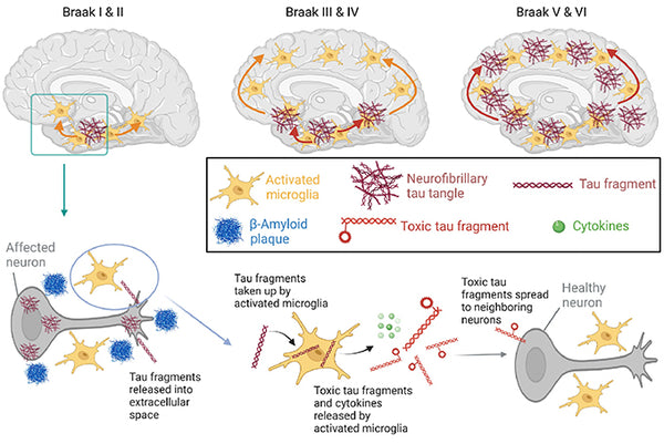 Neuron's damage as a result of Amyloid-β and tau proteins build-up in Alzheimer's 