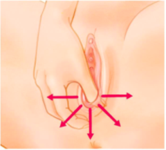 Perineal Massage Helen Keeble the pod collection 2