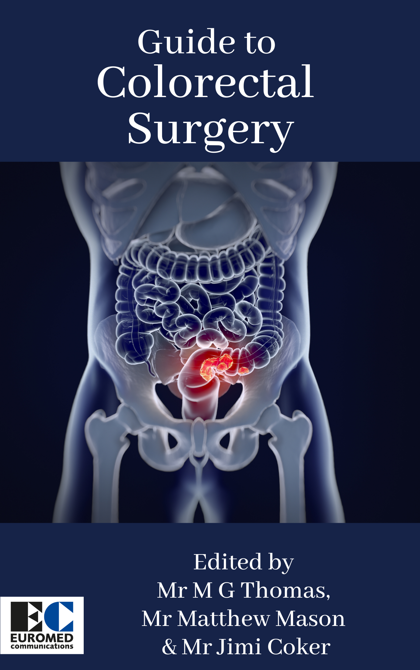 Guide To Colorectal Surgery Euromedcommunications 0568