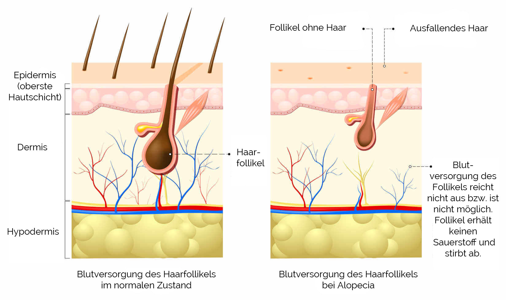 Vorgang Dermaroller Haare