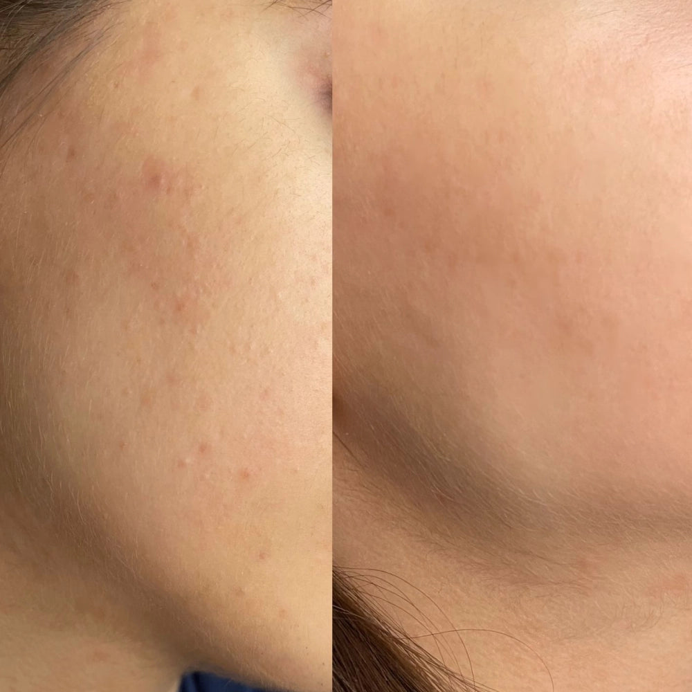 before-after-2.webp__PID:6c16964a-60e4-43c7-a5c3-8f988da8f814